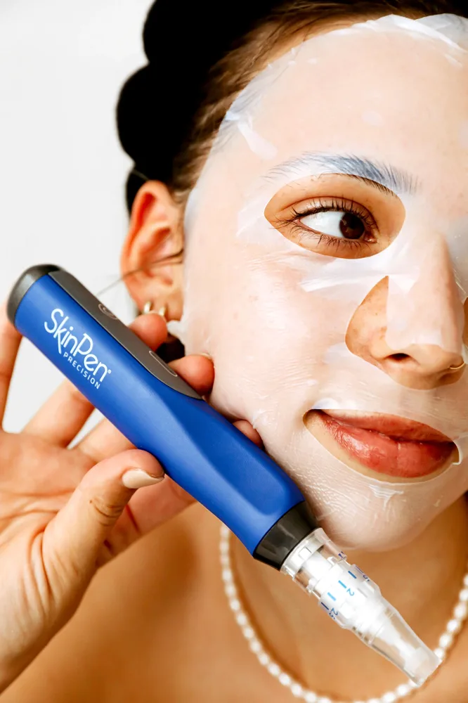 A client receiving a Microneedling treatment with a SkinPen® device on their face.