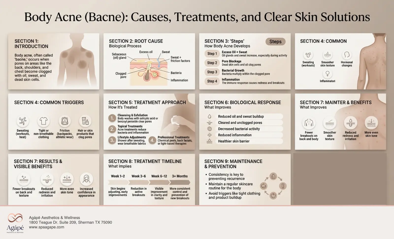 An infographic detailing body acne causes, treatments, and solutions for clearer skin.